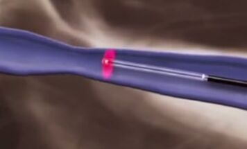 Термични обработки