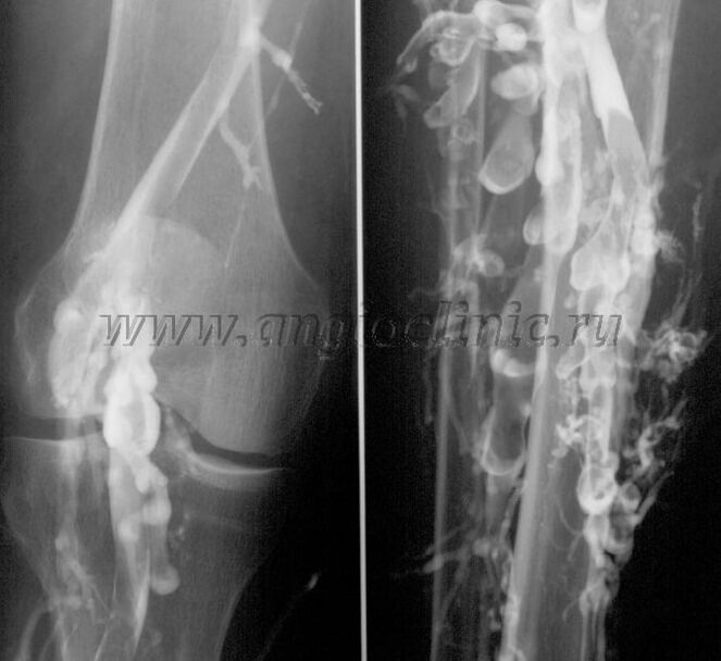 Ултразвуково сканиране